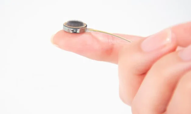 Connexus: el implante cerebral para curar la parálisis y los problemas del habla