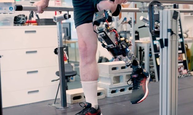 Nueva rodilla biónica permite mejor la movilidad en personas amputadas